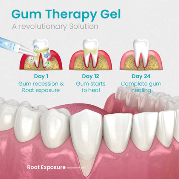 NESLEMY Gum Shield Therapy Gel