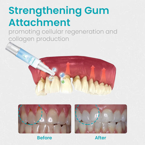 NESLEMY Gum Shield Therapy Gel