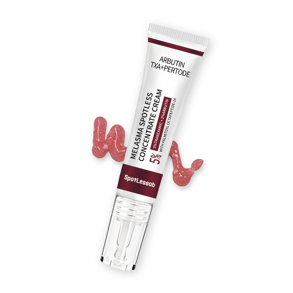 SpotLessab Radiance Dark Spot Correcting Cream for Melasma and Freckles