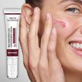 SpotLessab Radiance Dark Spot Correcting Cream for Melasma and Freckles