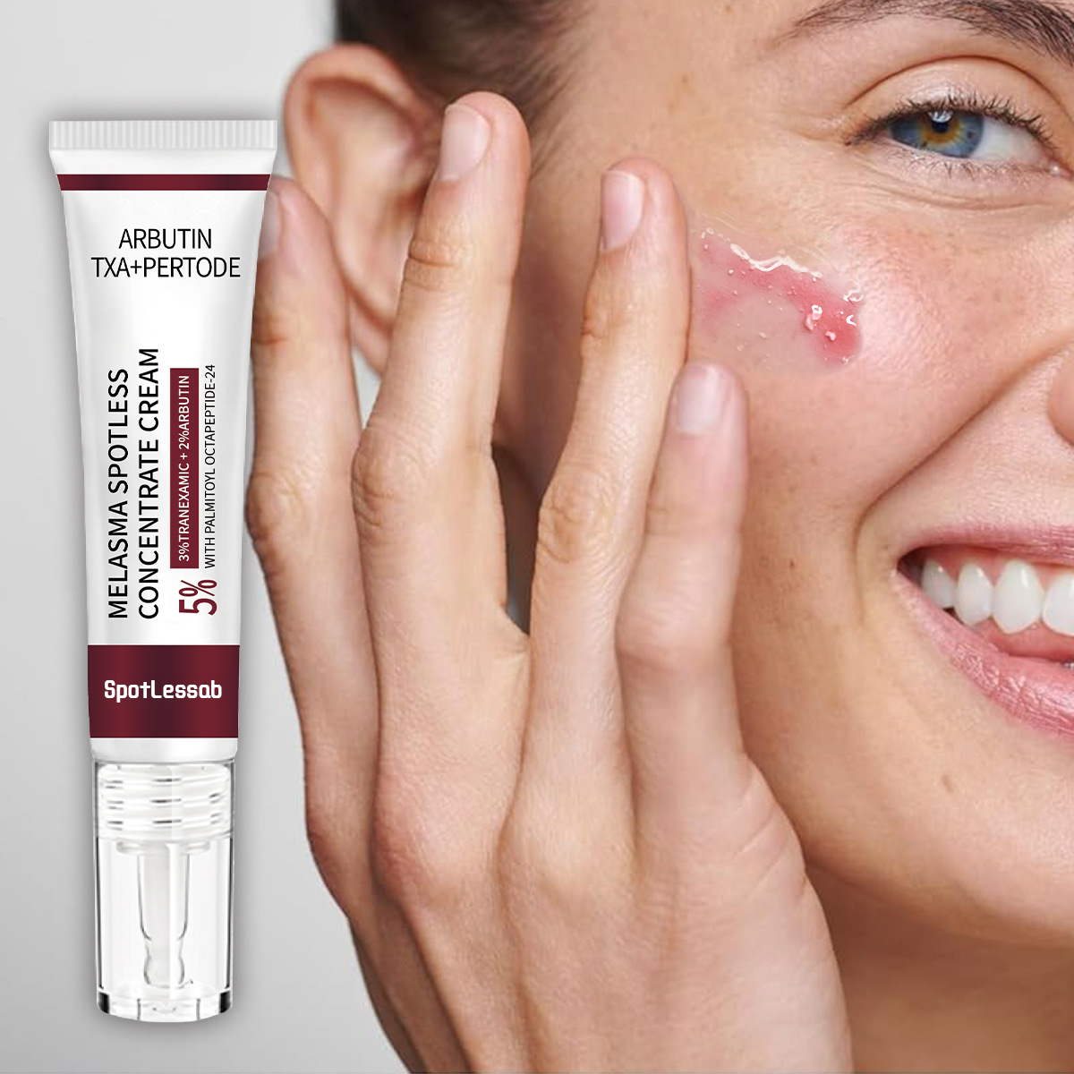 SpotLessab Radiance Dark Spot Correcting Cream for Melasma and Freckles