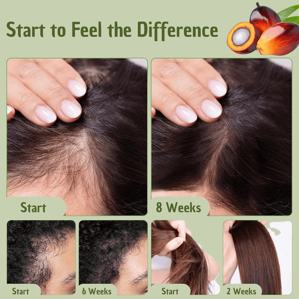Batana Hair Oil – Ultimate Hydration, Strength & Protection for Healthy Hair | Omega Fatty Acids & Vitamin E