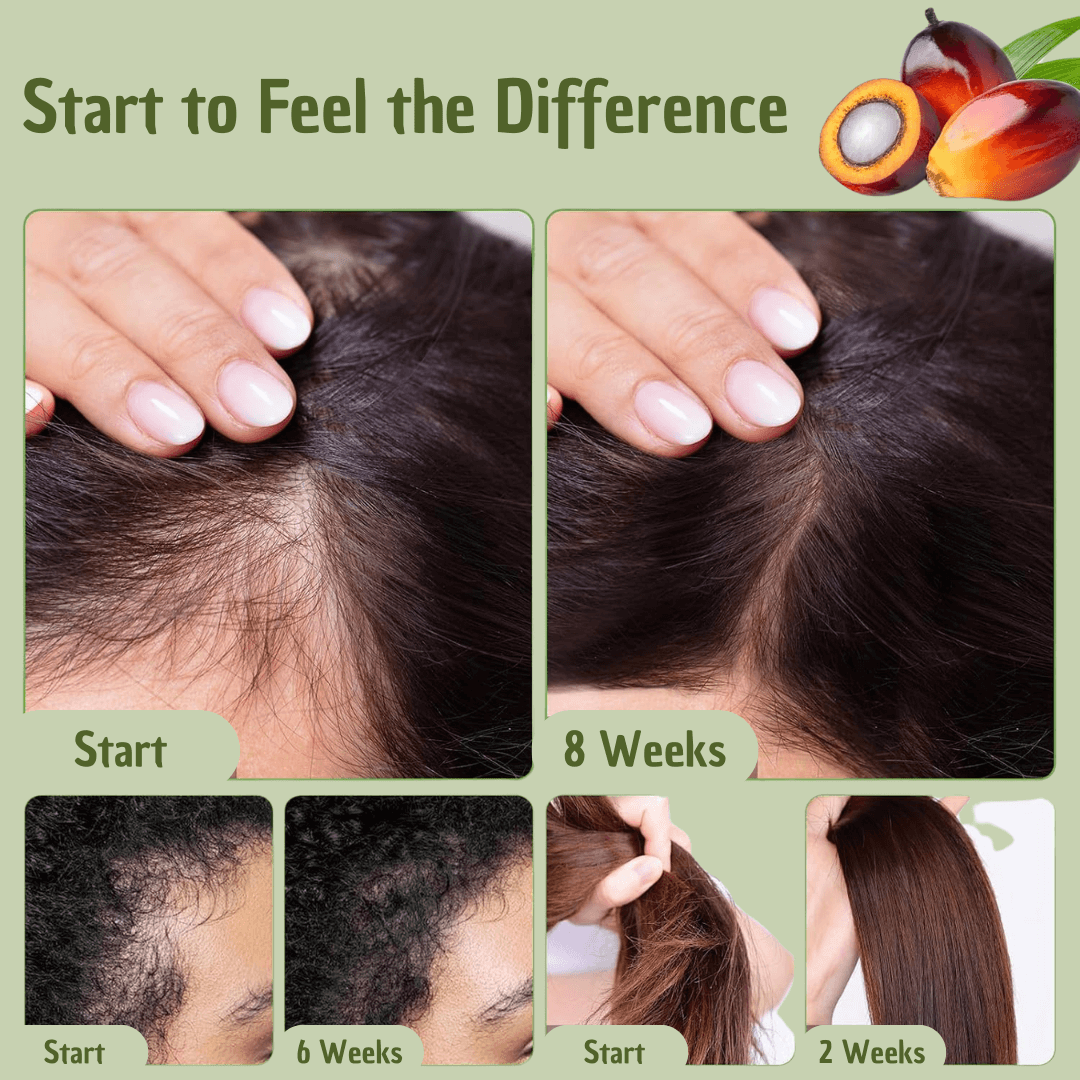 Batana Hair Oil – Ultimate Hydration, Strength & Protection for Healthy Hair | Omega Fatty Acids & Vitamin E