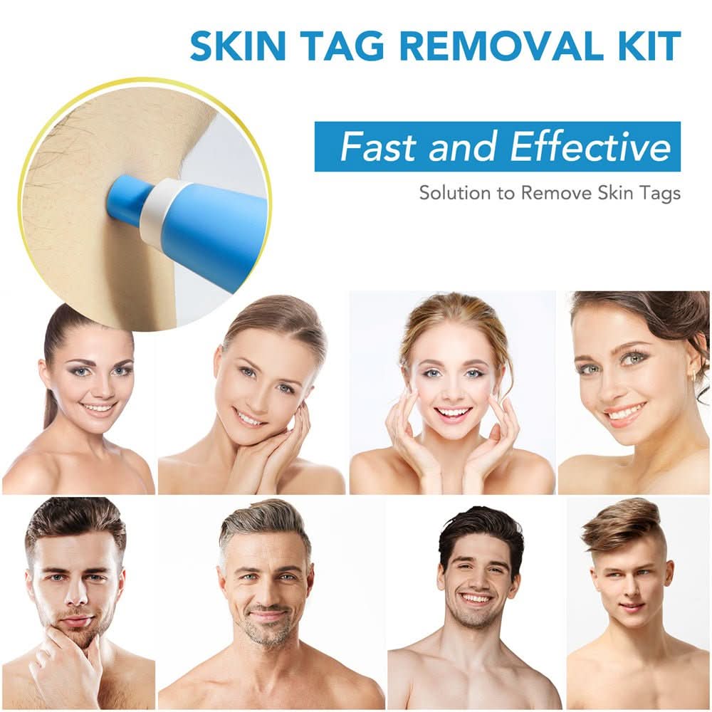 EPICLEAR – At-Home Skin Tag & Wart Remover Kit